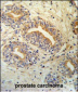 CWC15 Antibody (Center)